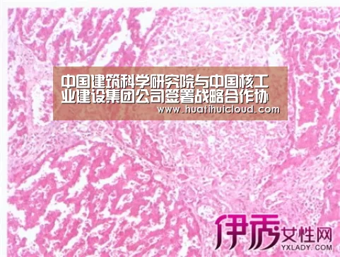 中国建筑科学研究院与中国核工业建设集团公司签署战略合作协议:华体会体育网页版(图1) 华体会体育网站入口